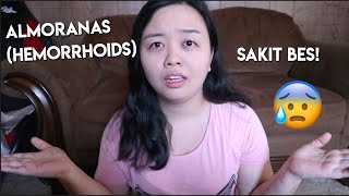 PAANO MAWALA ANG ALMORANAS HEMORRHOIDS [upl. by Enialehs]