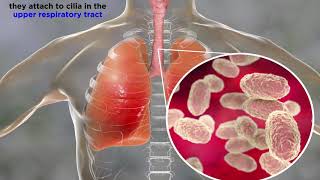 Gram Negative Bacteria Bordetella Pertussis [upl. by Onfroi]