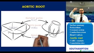 Open Aortic Aneurysm Repair [upl. by Hathaway392]