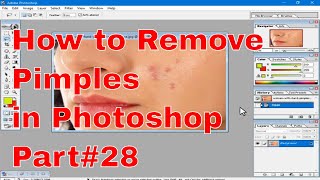 Learn Photoshop 28 How to remove pimples Photoshop in Telugu [upl. by Asirahc521]