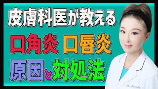 【口角炎】口角炎・口唇炎の原因・対象方・治し方を皮膚科医が教えます！ [upl. by Alrich]