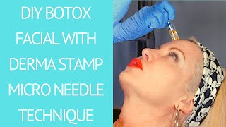 DIY Botox Facial With Derma Stamp Microneedling [upl. by Xanthe]