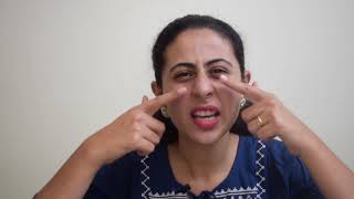 Signs And Symptoms Of Bells Palsy [upl. by Fidele]