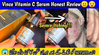 Vince Vitamin C Serum Review UNSPONSORED UNPAID review [upl. by Jory992]