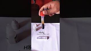 hbsag test  hbsag positive test  hbsag test kya hota hai  shorts  youtubeshorts  hbsag [upl. by Robbins]