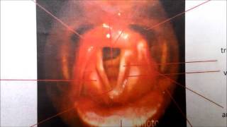 How to identify anatomical landmarks during FEES amended [upl. by Akinuahs]