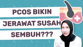 Kenapa Jerawat Susah Sembuh Janganjangan PCOS  dr Vania Utami [upl. by Lashoh]