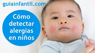 Cómo reconocer una reacción alérgica en un niño y cuándo llevarle a urgencias  Alergias infantiles [upl. by Nailliw430]