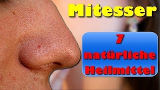 Mitesser – 7 Natürliche Heilmittel gegen Mitesser und Pickel [upl. by Witte623]