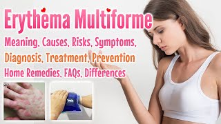 Erythema Multiforme Overview Causes Risks Symptoms Treatment Prevention Home Remedies and FAQs [upl. by Richman806]