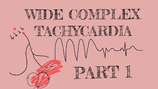 Wide complex tachycardia  Part 1 [upl. by Arretnahs]