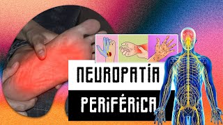 Neuropatía periférica [upl. by Adlitam655]