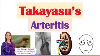 Takayasu Arteritis  Dr Shruti Bajad skincare arthritis autoimmunecare skin arthritispain [upl. by Essex47]