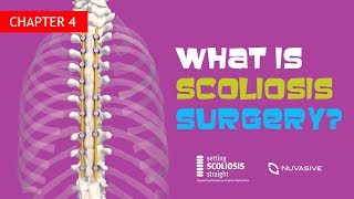 My Scoliosis Story  Spinal Fusion Surgery 2019 [upl. by Bret453]