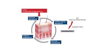 VITILIGO What is hypopigmentation [upl. by Stoneham]