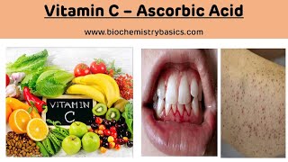 Vitamin C  Ascorbic Acid  Vitamin C Biochemistry  Scurvy [upl. by Drusie]