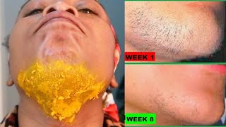 JUST 2 INGREDIENTS REMOVE FACIAL HAIR REMOVE FACIAL HAIR PERMANENTLY CHIN  UPPER LIPS [upl. by Ronoh285]