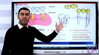 16 Fixed Prosthodontics Dental Bridge Classifications P1 [upl. by Tonneson]