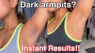 How To Get Rid Of Dark Armpits INSTANTLY 100 works [upl. by Ortensia]