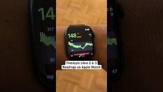 How to get Libre 2 amp 3 Readings on Apple Watch cgm t1d diabetes [upl. by Eedolem]