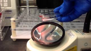 Blood Bank Antibody Screen Tube Method [upl. by Conway329]