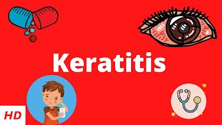 Keratitis Causes Signs and Symptoms Diagnosis and Treatment [upl. by Anailil]