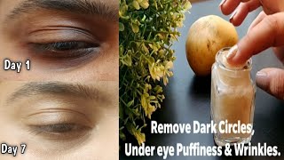 I Removed DARK CIRCLES in 7 Days with Potato Eye GelRemove under Eye CircleWrinkles amp Puffiness [upl. by Tareyn162]