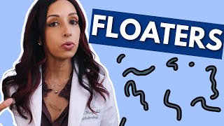 What Causes Eye Floaters Eye Doctor Explains [upl. by Schuster]