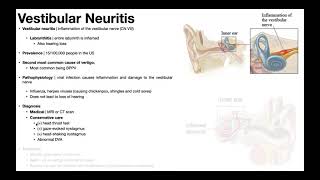 👂 Vestibular Neuritis  Presentation Pathophysiology Diagnosis amp Treatment [upl. by Slaohcin922]