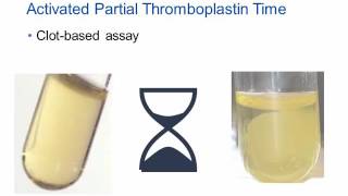 AntiXa Assay for Heparin Monitoring Hot Topic [upl. by Dweck]