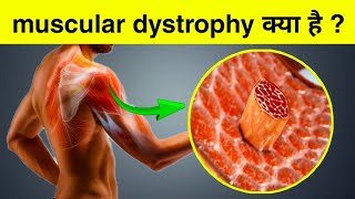 Muscular Dystrophy क्या हैं खतरनाक बीमारी [upl. by Carlina]