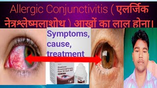 Allergic Conjunctivitis  एलर्जिक नेत्रश्लेष्मलाशोथ Abhia2zmedicalSymptoms cause treatment [upl. by Homer]