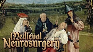 Middle Ages Surgery History of Neurosurgery [upl. by Nylehtak]