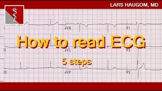 How to read ECG [upl. by Anelrahc321]