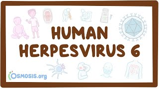 Human herpesvirus 6 Roseola  an Osmosis Preview [upl. by Long]