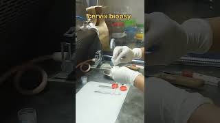 Cervical tissue biopsy  histopathology [upl. by Hanikehs768]