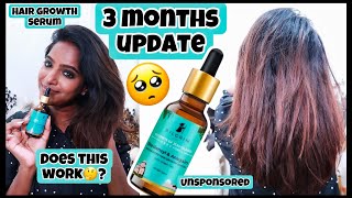 My 3 months update on the Pilgrim Redensyl amp Anagain Advanced Hair Growth SerumDoes this work☹️ [upl. by Annawat]