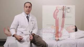 Iliotibial Band Syndrome Physical Exam  Stanford Medicine 25 [upl. by Aserahs720]