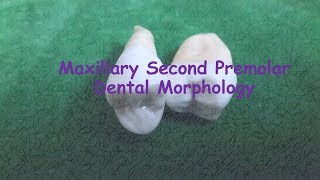 Maxillary second Premolar Dental anatomy [upl. by Arelc627]