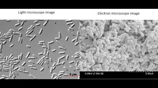 What do bacteria look like under a light vs electron microscope [upl. by Nomzaj256]