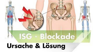 ISG Blockade  Symptome Ursachen amp Lösung durch Training [upl. by Darrelle]