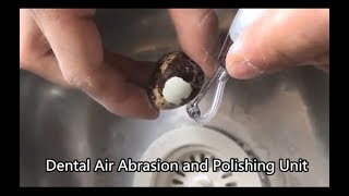 The Amazing Effect of Dental Air Abrasion and Polishing Unit [upl. by Anirroc822]