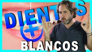 Probando las TIRAS BLANQUEADORAS para DIENTES  5D WHITE Mi OPINIÓN [upl. by Bak901]