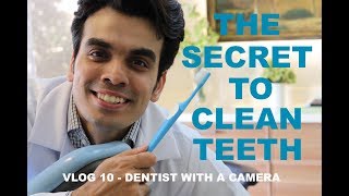 The Secret to Clean Teeth  Vlog 10  Dentist with a Camera [upl. by Gasparo]