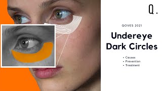 How to Get Rid Of Dark Circles amp Under Eye Puffiness [upl. by Endor]