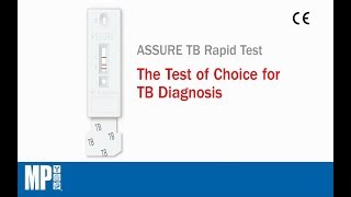 ASSURE TB Rapid Test [upl. by Ashelman]