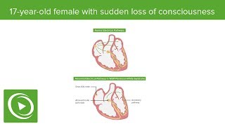 USMLE Step 1 Anatomy Question 4 Walkthrough Tutorial by DocOssareh  Lecturio [upl. by Eilagam]