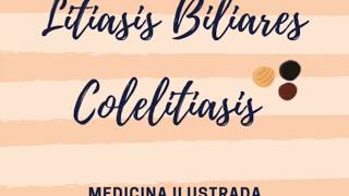 Colelitiasis cálculos o piedras Biliares [upl. by Stoddard956]