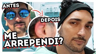 ANTES e DEPOIS da MINHA CIRURGIA de OTOPLASTIA  PREÇOS PERGUNTAS e VLOG COMPLETO da RECUPERAÇÃO [upl. by Penney]