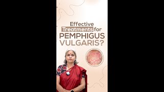 Effective Treatments for Pemphigus Vulgaris [upl. by Clauddetta794]